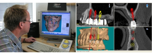 3D Planung